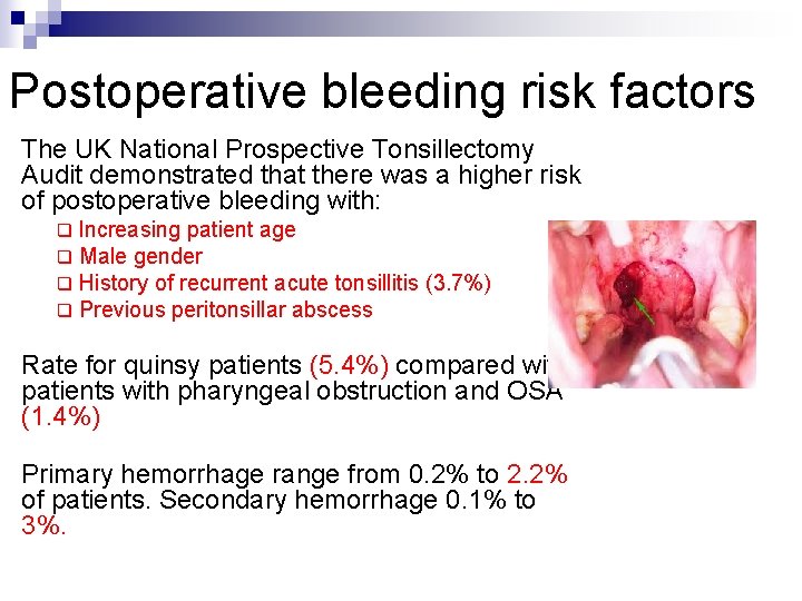 Postoperative bleeding risk factors The UK National Prospective Tonsillectomy Audit demonstrated that there was
