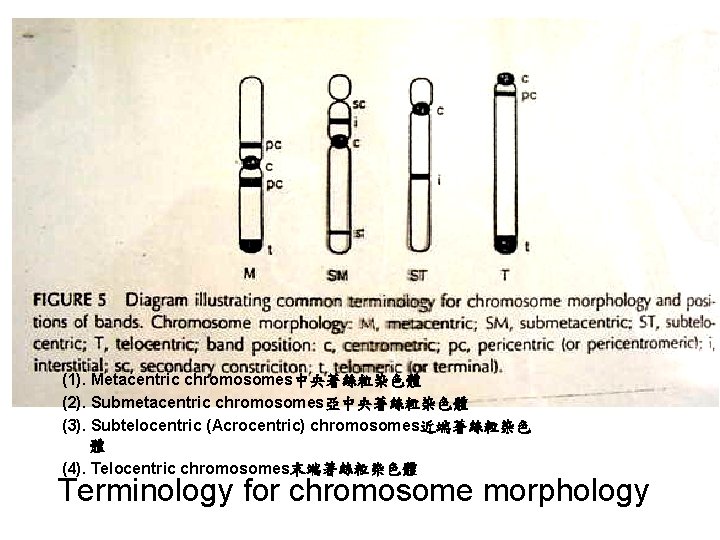 (1). Metacentric chromosomes中央著絲粒染色體 (2). Submetacentric chromosomes亞中央著絲粒染色體 (3). Subtelocentric (Acrocentric) chromosomes近端著絲粒染色 體 (4). Telocentric chromosomes末端著絲粒染色體