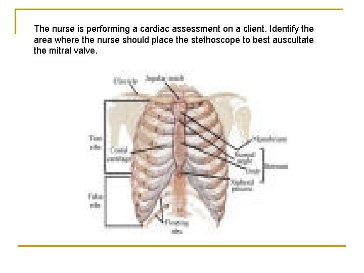 The nurse is performing a cardiac assessment on a client. Identify the area where