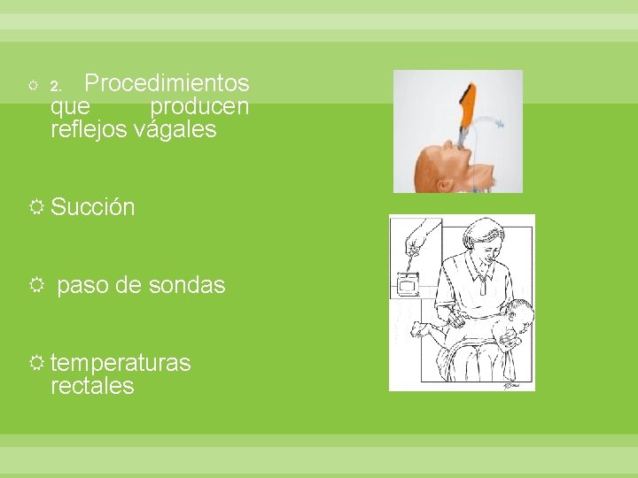 Procedimientos que producen reflejos vágales 2. Succión paso de sondas temperaturas rectales 
