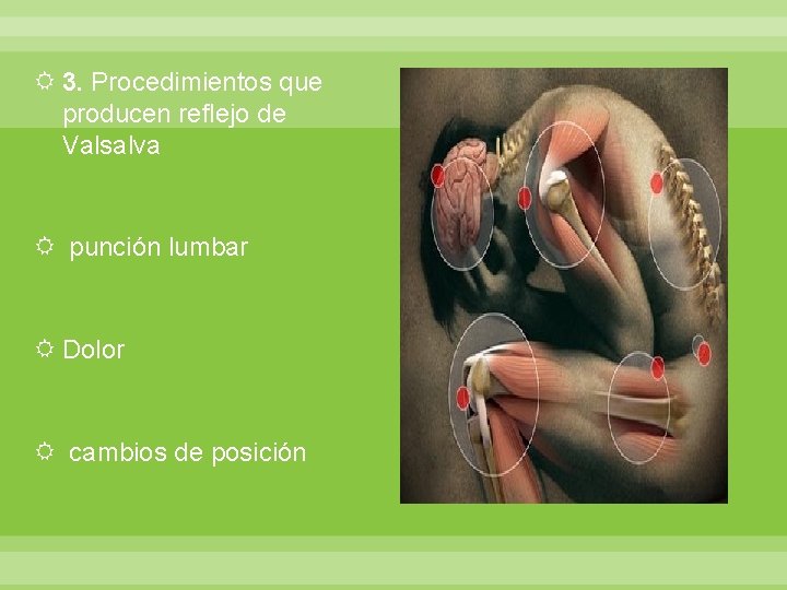  3. Procedimientos que producen reflejo de Valsalva punción lumbar Dolor cambios de posición