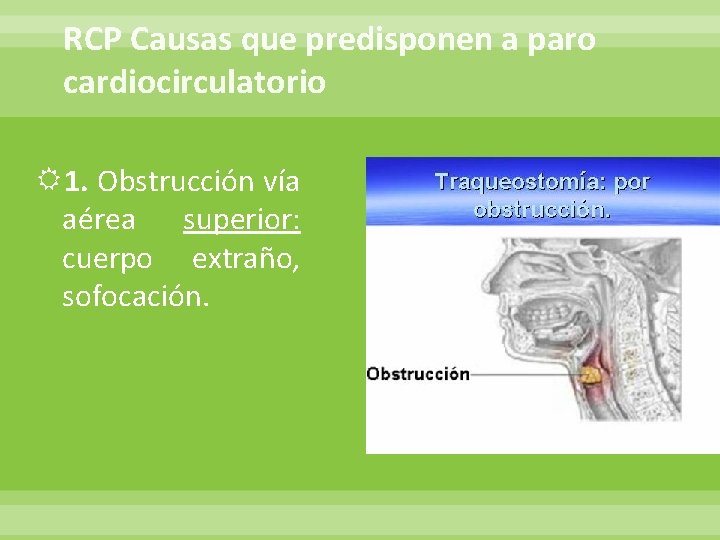 RCP Causas que predisponen a paro cardiocirculatorio 1. Obstrucción vía aérea superior: cuerpo extraño,