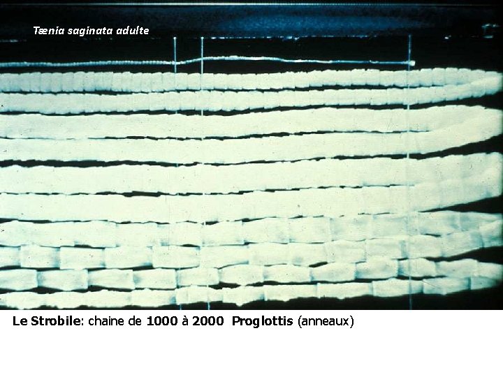 Tænia saginata adulte Le Strobile: chaine de 1000 à 2000 Proglottis (anneaux) 