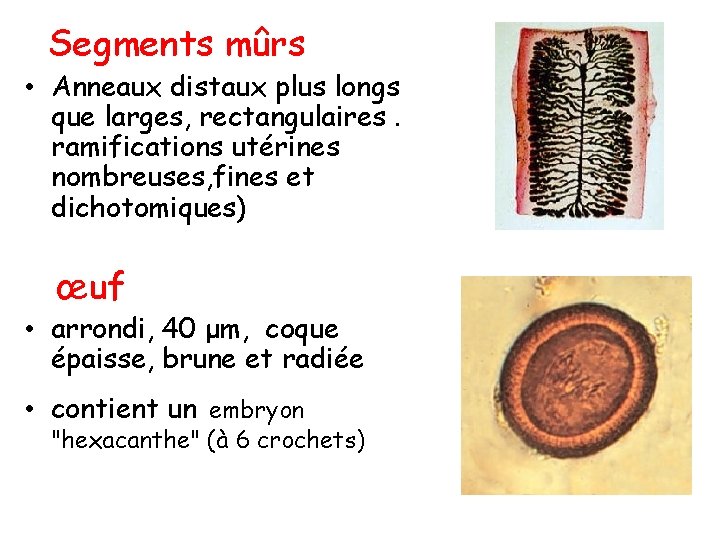 Segments mûrs • Anneaux distaux plus longs que larges, rectangulaires. ramifications utérines nombreuses, fines