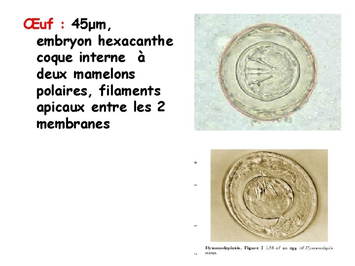 Œuf : 45μm, embryon hexacanthe coque interne à deux mamelons polaires, filaments apicaux entre