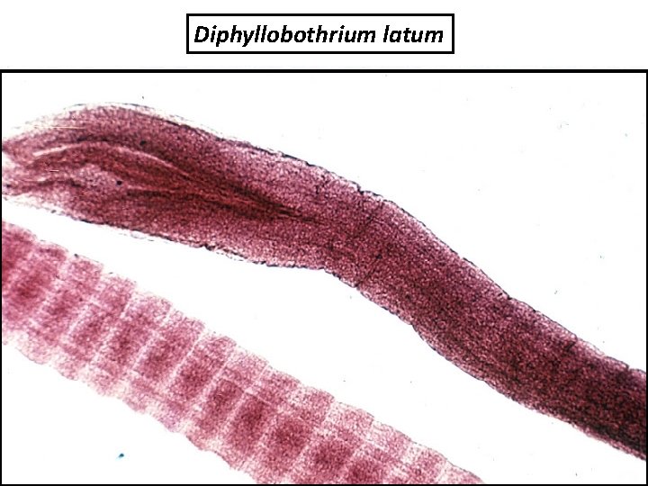 Diphyllobothrium latum 