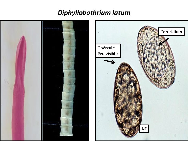 Diphyllobothrium latum Coracidium Opércule Peu visible NE 