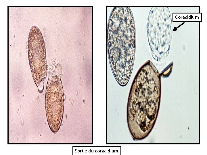 Coracidium Sortie du coracidium 