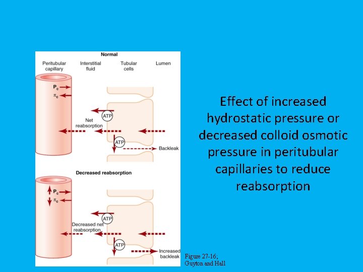 Effect of increased hydrostatic pressure or decreased colloid osmotic pressure in peritubular capillaries to