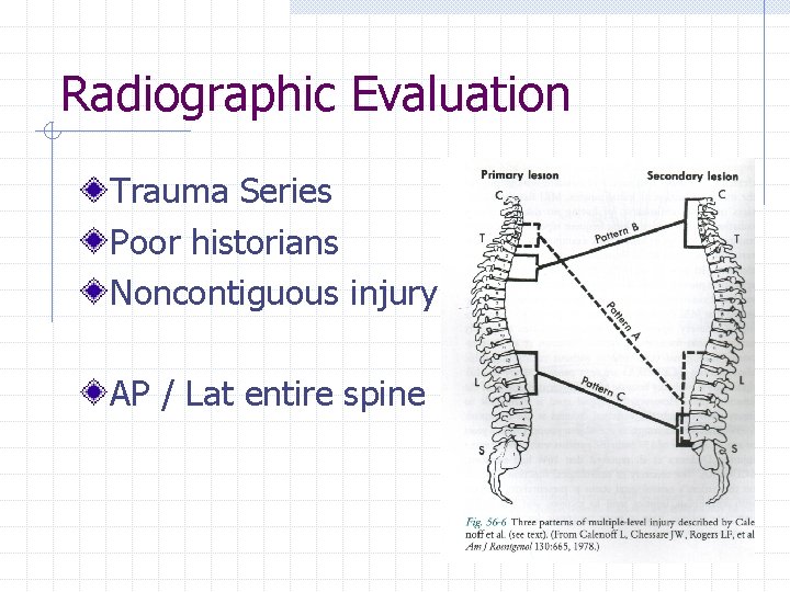 Radiographic Evaluation Trauma Series Poor historians Noncontiguous injury AP / Lat entire spine 