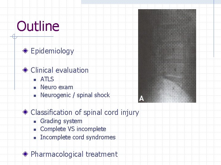 Outline Epidemiology Clinical evaluation n ATLS Neuro exam Neurogenic / spinal shock Classification of
