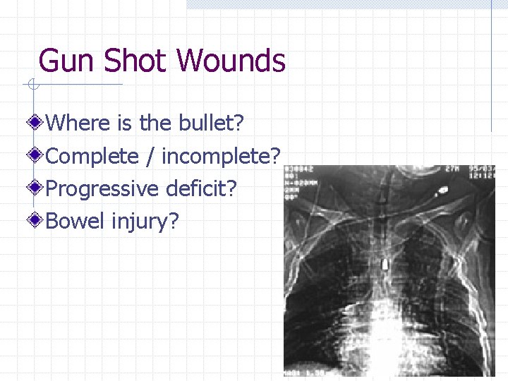 Gun Shot Wounds Where is the bullet? Complete / incomplete? Progressive deficit? Bowel injury?