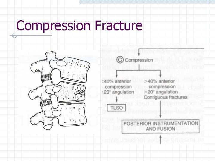 Compression Fracture 