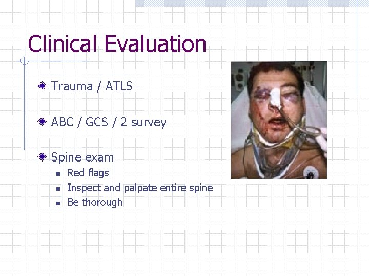 Clinical Evaluation Trauma / ATLS ABC / GCS / 2 survey Spine exam n
