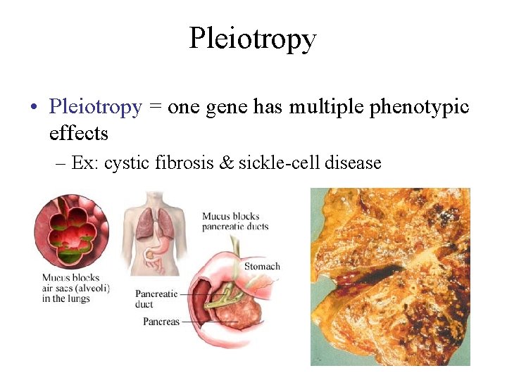 Pleiotropy • Pleiotropy = one gene has multiple phenotypic effects – Ex: cystic fibrosis