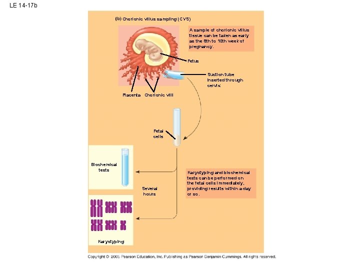 LE 14 -17 b Chorionic villus sampling (CVS) A sample of chorionic villus tissue