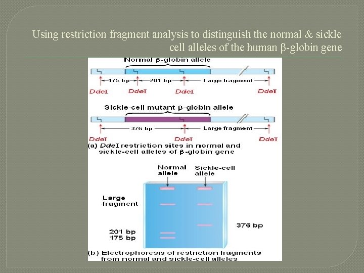 Using restriction fragment analysis to distinguish the normal & sickle cell alleles of the