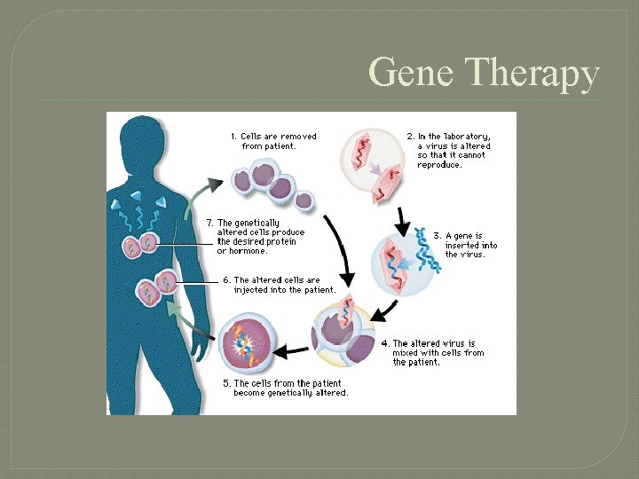Gene Therapy 