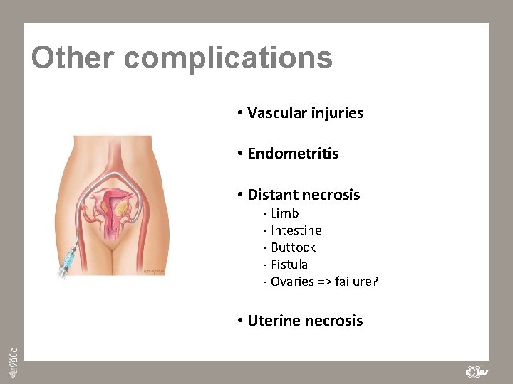 Other complications • Vascular injuries • Endometritis • Distant necrosis - Limb - Intestine