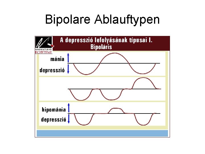 Bipolare Ablauftypen 