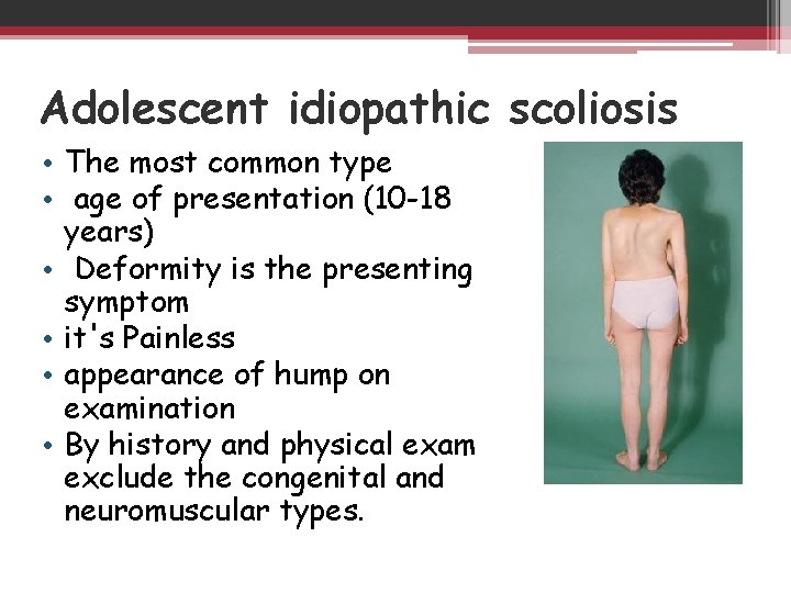 Adolescent idiopathic scoliosis • The most common type • age of presentation (10 -18