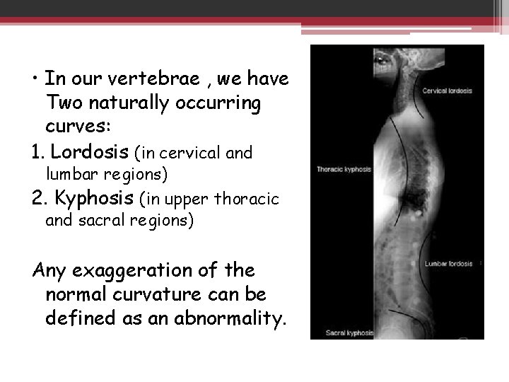  • In our vertebrae , we have Two naturally occurring curves: 1. Lordosis