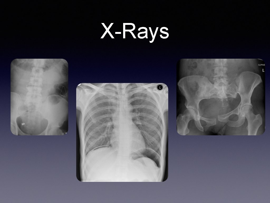 X-Rays 