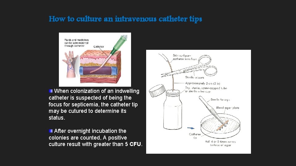 How to culture an intravenous catheter tips When colonization of an indwelling catheter is