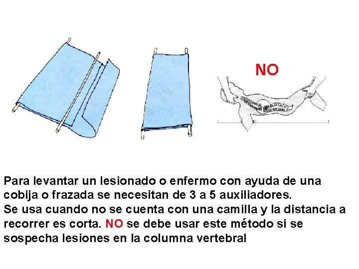  NO Para levantar un lesionado o enfermo con ayuda de una cobija o