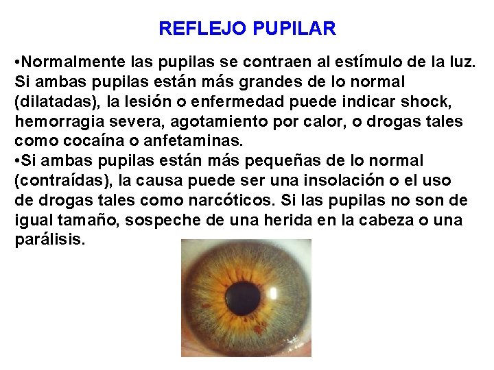 REFLEJO PUPILAR • Normalmente las pupilas se contraen al estímulo de la luz. Si