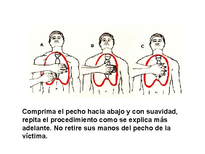 Comprima el pecho hacia abajo y con suavidad, repita el procedimiento como se explica