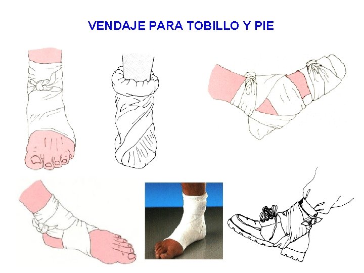 VENDAJE PARA TOBILLO Y PIE 