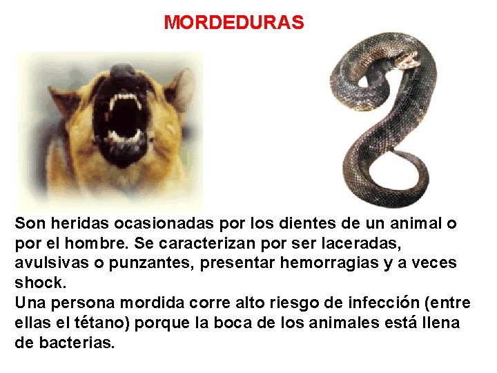 MORDEDURAS Son heridas ocasionadas por los dientes de un animal o por el hombre.