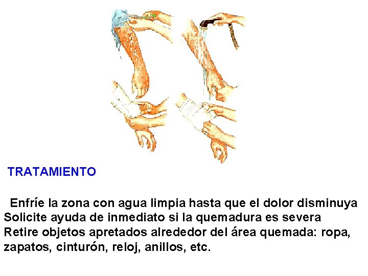 TRATAMIENTO Enfríe la zona con agua limpia hasta que el dolor disminuya Solicite ayuda