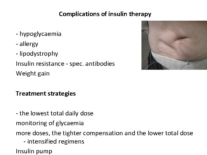 Complications of insulin therapy - hypoglycaemia - allergy - lipodystrophy Insulin resistance - spec.