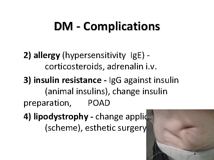 DM - Complications 2) allergy (hypersensitivity Ig. E) - corticosteroids, adrenalin i. v. 3)