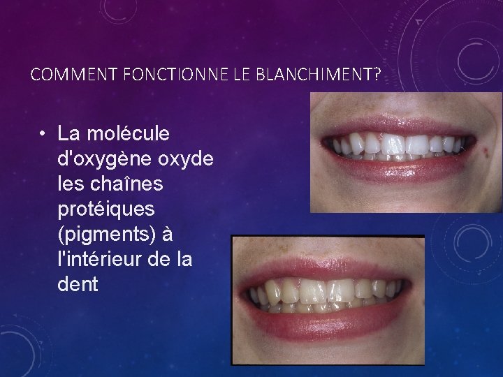 COMMENT FONCTIONNE LE BLANCHIMENT? • La molécule d'oxygène oxyde les chaînes protéiques (pigments) à