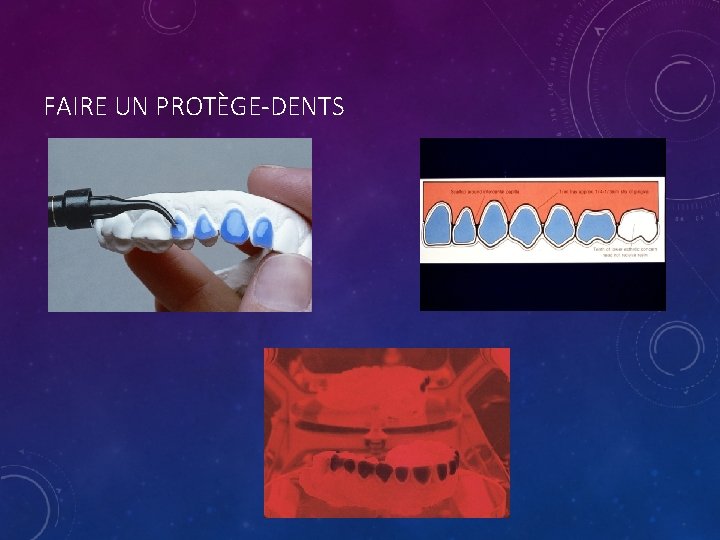 FAIRE UN PROTÈGE-DENTS 