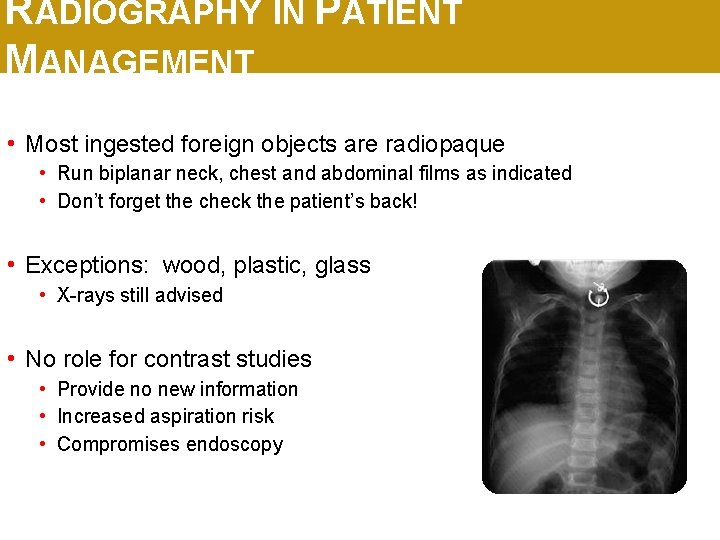 RADIOGRAPHY IN PATIENT MANAGEMENT • Most ingested foreign objects are radiopaque • Run biplanar