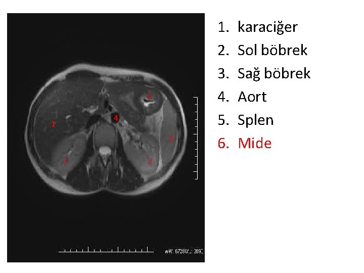 6 4 1 5 3 2 1. 2. 3. 4. 5. 6. karaciğer Sol