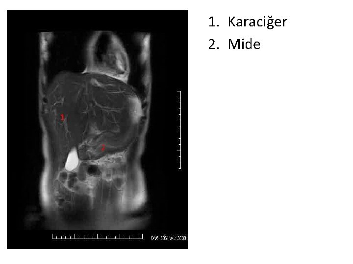 1. Karaciğer 2. Mide 1 2 