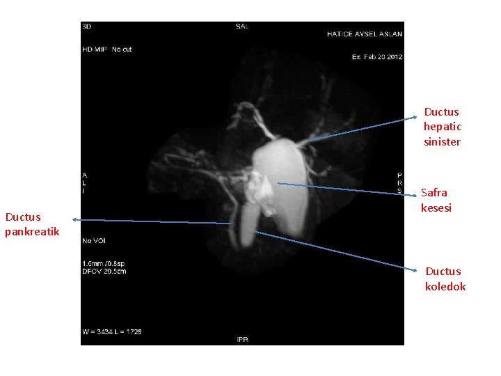 Ductus hepatic sinister Ductus pankreatik Safra kesesi Ductus koledok 