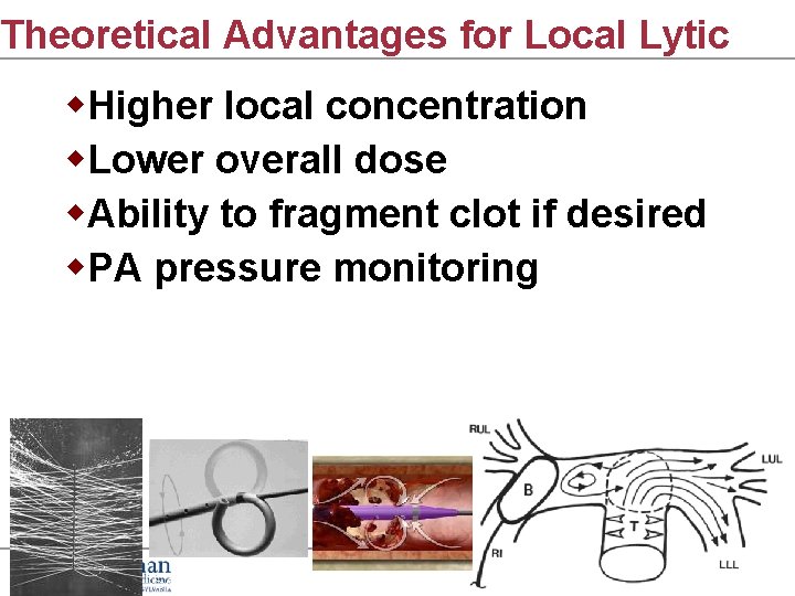 Theoretical Advantages for Local Lytic w. Higher local concentration w. Lower overall dose w.