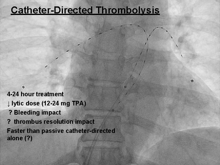 Catheter-Directed Thrombolysis 4 -24 hour treatment ↓ lytic dose (12 -24 mg TPA) ?