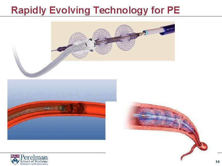Rapidly Evolving Technology for PE 14 