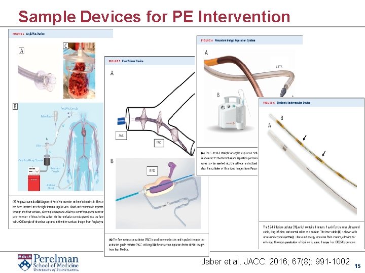 Sample Devices for PE Intervention Jaber et al. JACC. 2016; 67(8): 991 -1002 15