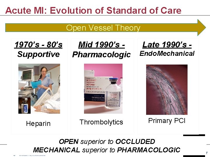 Acute MI: Evolution of Standard of Care Open Vessel Theory Late 1990’s - 1970’s