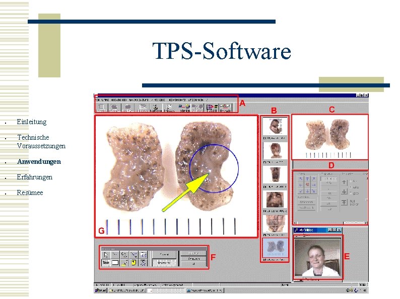 TPS-Software ● ● Einleitung Technische Voraussetzungen ● Anwendungen ● Erfahrungen ● Resümee 