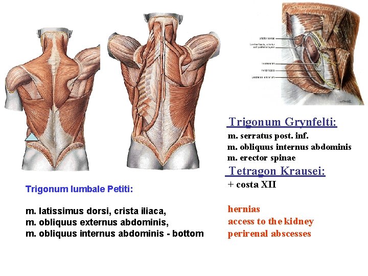 Trigonum Grynfelti: m. serratus post. inf. m. obliquus internus abdominis m. erector spinae Tetragon