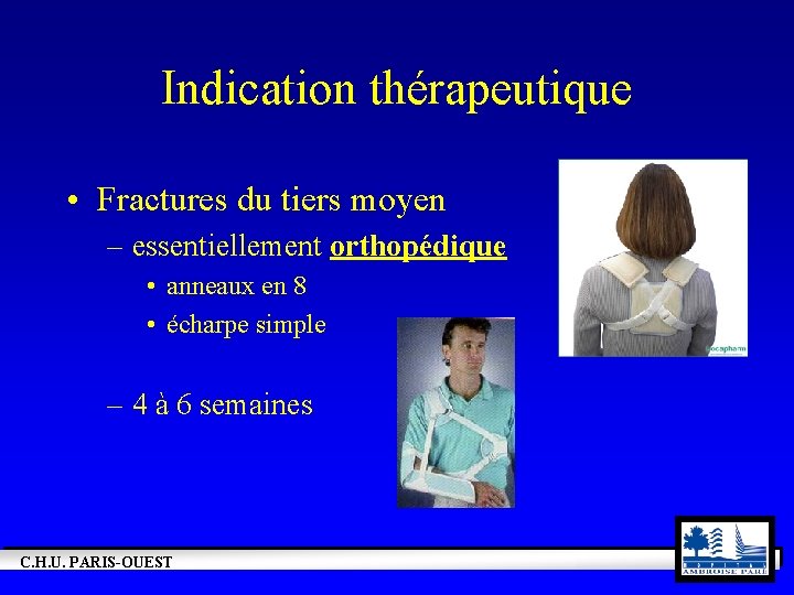 Indication thérapeutique • Fractures du tiers moyen – essentiellement orthopédique • anneaux en 8